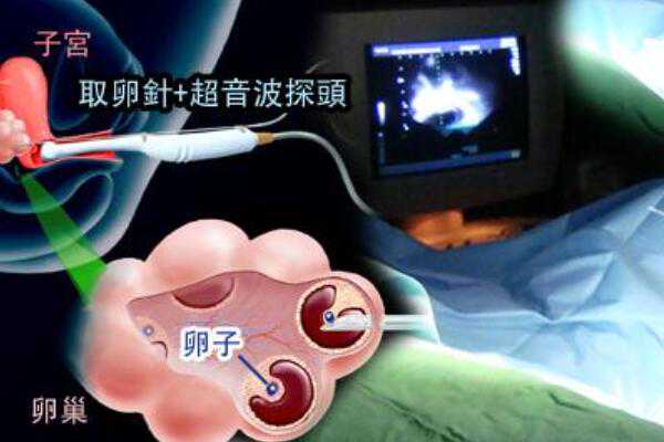 深圳助孕孩子qq群号,影响深圳市第三代试管婴儿成功率的因素有哪些？