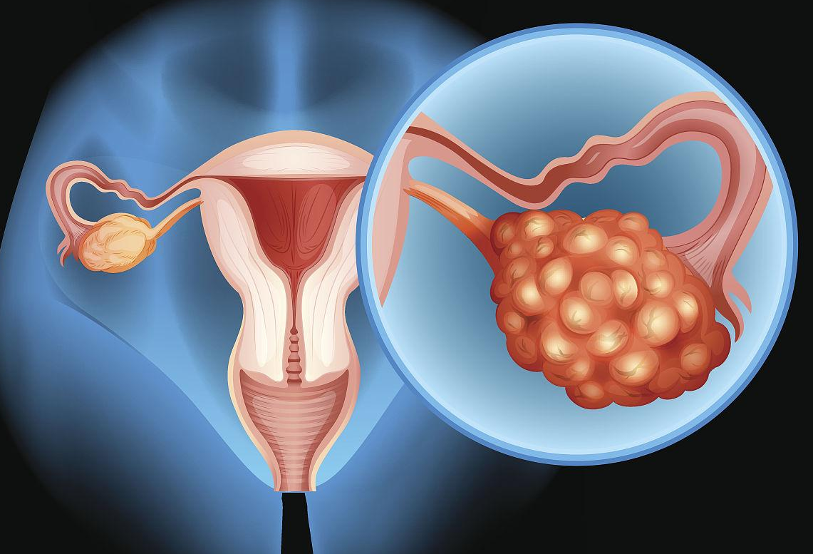 试管同时供精供卵的医院&囊胚移植是否怀孕,内分泌失调如何调理？